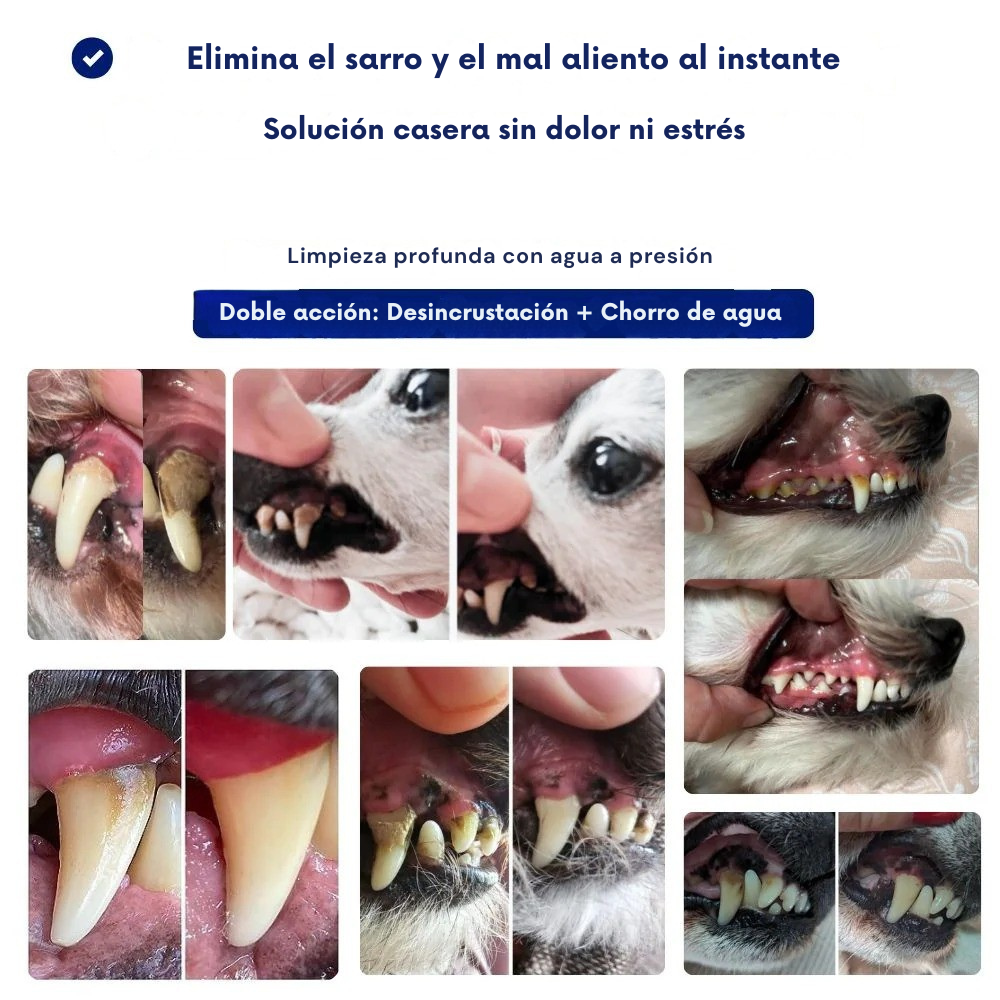 Cepillo Ultrasónico Antisarro